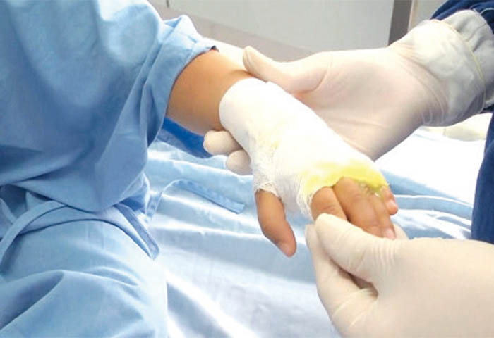 Salud reporta 102 quemados con pólvora