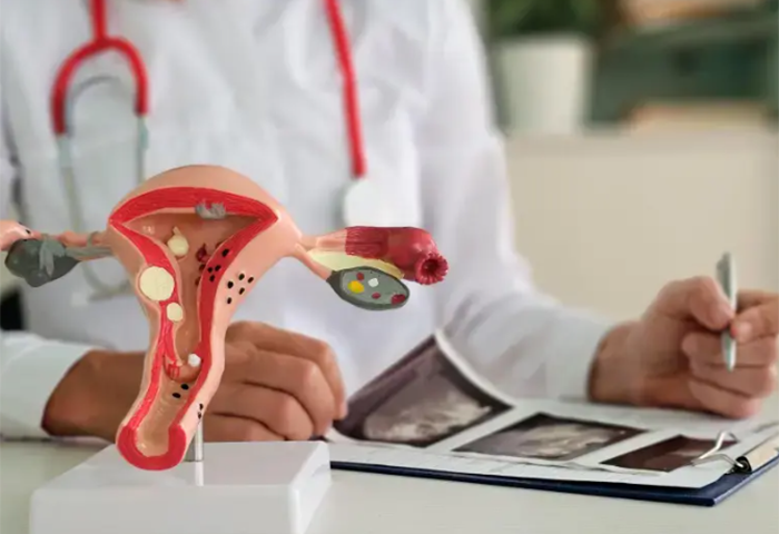 Juez ordena al MinSalud implementar a fondo ley de endometriosis ya aprobada: “no puede quedar en el papel”